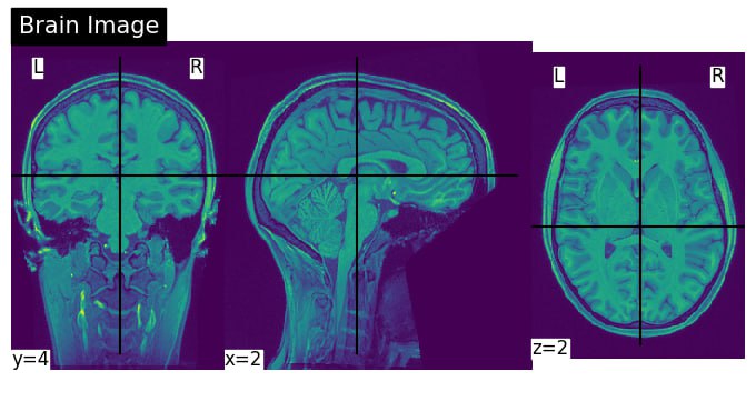 Brain